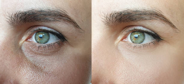 In-Clinic Aesthetic Treatments on Long Island: Botox & Microneedling with Drip Gym